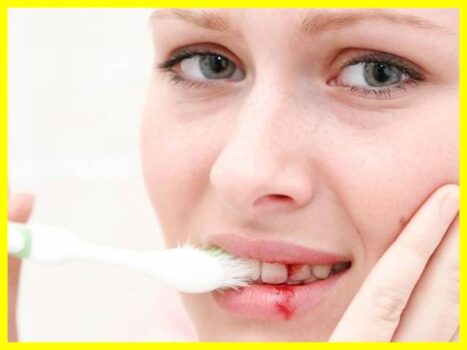 Mơ thấy đánh răng chảy máu có điềm báo gì? Tốt hay Xấu